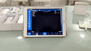 OB GYN डायग्नोस्टिक्स के लिए डुअल हेड वायरलेस अल्ट्रासाउंड जांच