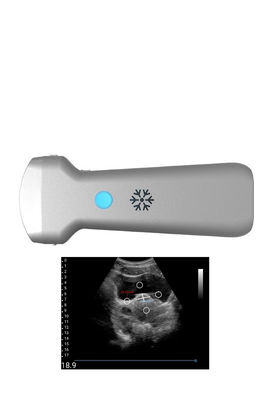 खरीदें स्त्री रोग के लिए Ultrasonication उत्तल वायरलेस अल्ट्रासाउंड जांच online manufacture