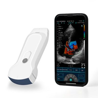 खरीदें क्लिनिकल डायग्नोसिस के लिए POCUS पोर्टेबल आईपैड हैंडहेल्ड अल्ट्रासाउंड स्कैनर online manufacture