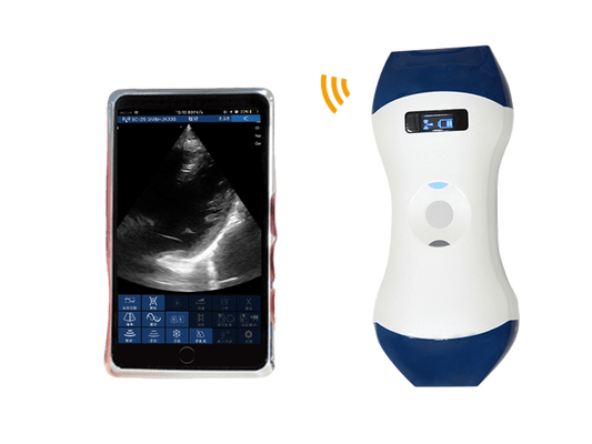 खरीदें FDA CE ISO13485 POCUS के लिए चरणबद्ध ऐरे और लीनियर डुअल हेड के साथ पाम साइज वायरलेस हैंडहेल्ड अल्ट्रासाउंड जांच online manufacture