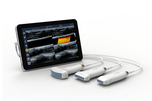 संवहनी और POCUS के लिए यूएसबी टाइप-सी लीनियर हैंडहेल्ड अल्ट्रासाउंड स्कैनर 10 मेगाहर्ट्ज पोर्टेबल एंड्रॉइड अल्ट्रासाउंड जांच