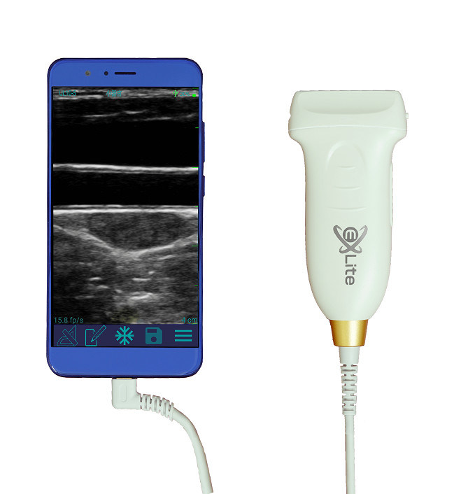 संवहनी और POCUS के लिए यूएसबी टाइप-सी लीनियर हैंडहेल्ड अल्ट्रासाउंड स्कैनर 10 मेगाहर्ट्ज पोर्टेबल एंड्रॉइड अल्ट्रासाउंड जांच