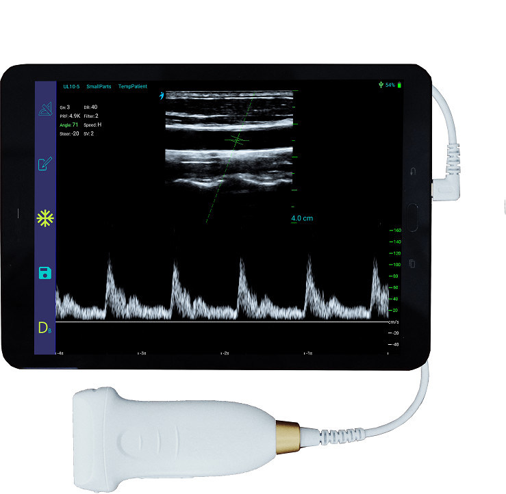 संवहनी और POCUS के लिए यूएसबी टाइप-सी लीनियर हैंडहेल्ड अल्ट्रासाउंड स्कैनर 10 मेगाहर्ट्ज पोर्टेबल एंड्रॉइड अल्ट्रासाउंड जांच